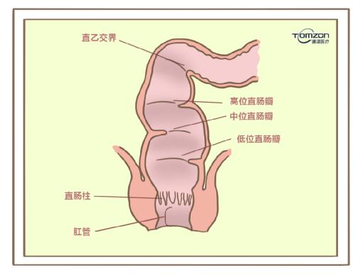 盆底康復治療儀對產(chǎn)后便秘有哪些幫助？