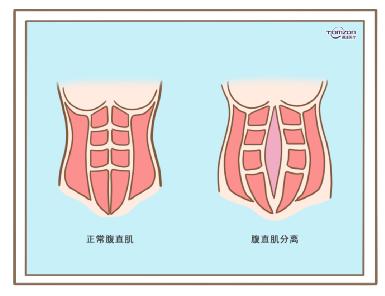 盆底康復(fù)治療儀效果到底怎么樣？