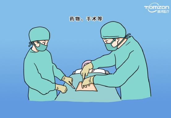 盆底治療儀應(yīng)該什么時候使用？