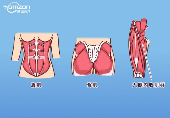 凱格爾運(yùn)動(dòng)該怎么做？盆底肌修復(fù)儀器還能用嗎？