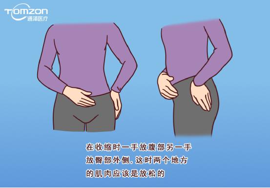 盆底康復(fù)治療儀能不能改善腹直肌分離？