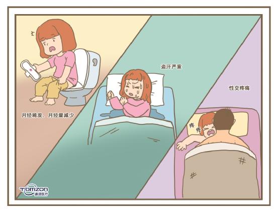使用盆底肌康復儀必要嗎？